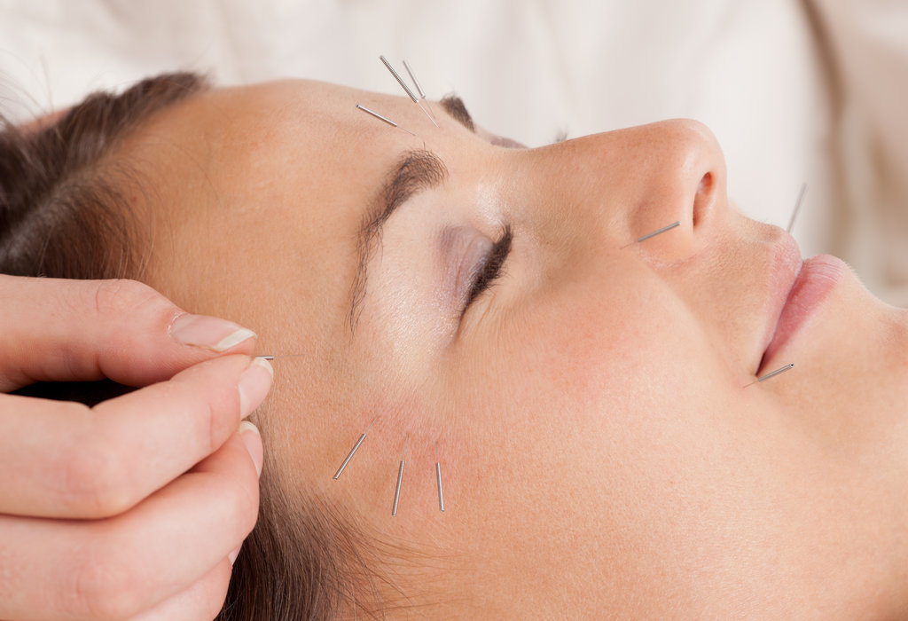 
What is acupuncture, and how does it work? During an acupuncture treatment, the practitioner inserts fine, sterile needles into specific pressure points on the skin to create local reactions. It is based in traditional Chinese medicine, wherein qi, or energy, flows along certain channels (known as meridians) in the body to keep you balanced. Should the qi be disrupted or blocked, acupuncture can stimulate and unblock the qi, activating healing responses in your body. 
Though these beliefs are different from Western medicine, modern research has proven that acupuncture therapy can have significant effects on your body's various systems. Dr. Zhang blends Western and Eastern medicine to get the best results for each patient. "For example, Chinese medicine states that if the lung is healthy, skin is healthy, but Western medicine says liver toxins can be the cause of poor skin health. Based on the needs of each patient, I choose which route to go for treatment."
What skin conditions can be treated with acupuncture? "Acne, wrinkles, dermatitis, and eczema can all be treated with acupuncture," said Dr. Zhang. "Sagging, dark spots, dullness, and enlarged pores can be improved, and even some types of hair loss respond to acupuncture." Issues like male-pattern baldness and deeply damaged skin may be harder to treat. In his practice, he frequently treats acne, eczema, psoriasis, and hair loss caused by stress.
