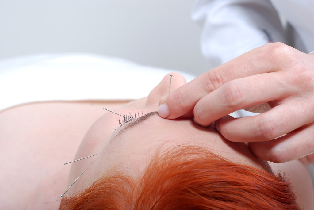 
How does acupuncture work for skin? There are two primary reasons to treat your skin with acupuncture therapy — health and beauty — and they are often connected. As you likely know from experience, nearly anything can affect your complexion, from stress, poor sleep, and a bad diet to hormonal imbalances and environmental factors. "An acupuncturist must first diagnose the cause for a patient’s skin problem then select proper acupuncture points for the treatment," Dr. Zhang explained. The acupuncturist can then treat the skin concern locally (on or around it) and/or via the meridians connected to the concern. To illustrate, Dr. Zhang cited a specific case: "Hormones play an important part in some skin conditions. One female patient was suffering from very bad acne and an irregular period from her birth control medicine. After six treatments of focusing directly on her skin condition and her hormone points, her period became consistent and her acne was tremendously improved."
How do you treat signs of aging with acupuncture? Acupuncturists treat concerns like fine lines, wrinkles, and sagging with local treatments nicknamed the "acupuncture face-lift." Dr. Zhang told me that cosmetic acupuncture has been used since the Sung Dynasty (960-1279 AD) and kept the empress looking youthful. By inserting needles into specific points on the face, acupuncturists can stimulate collagen turnover and blood flow to nourish the skin and reduce the appearance of wrinkles.
